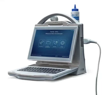 SY-A00A3 hot prodej Kostní minerální hustota skener Kostní hmoty lékařské nemocnice Digitální Ultrazvukový Kostní Denzitometr