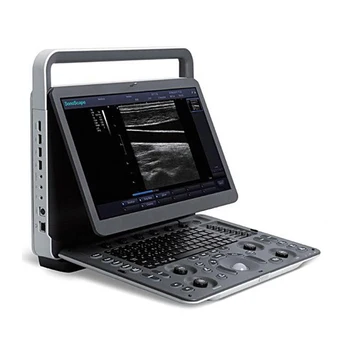 Nejprodávanější E2 ecografo sonoscape ultrazvukový přístroj přenosný přenosný ultrazvukový přístroj SonoScape